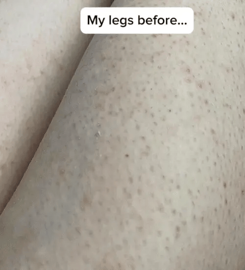 1 + 1 GRATIS IDAG DermaBare™