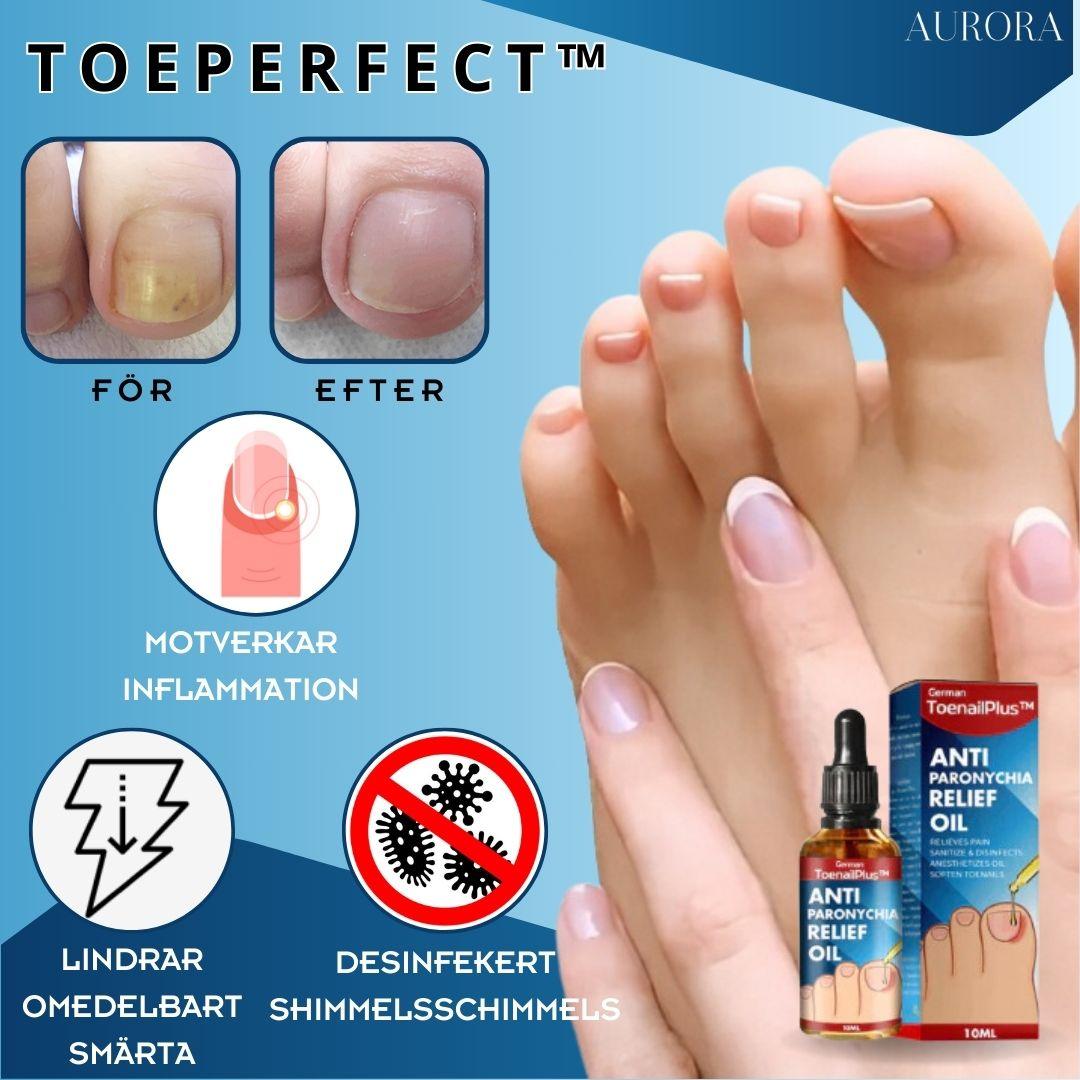 ToePerfect⹠- LÀker tÄnaglar och handnaglar | 1+1 FREE TEMPORARY - Aurora Stockholm