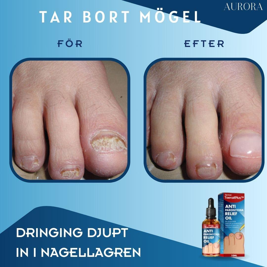 ToePerfect⹠- LÀker tÄnaglar och handnaglar | 1+1 FREE TEMPORARY - Aurora Stockholm