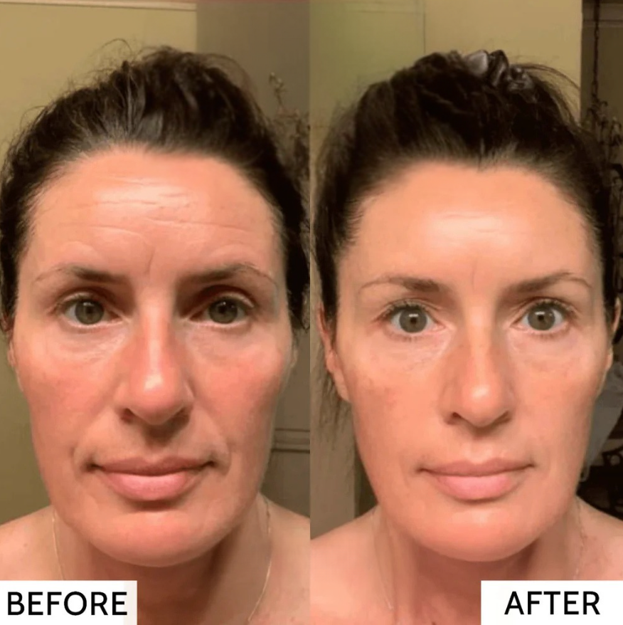 TILLFÄLLIGT 50% RABATT | RevitaMask™ | Hudkollagenmask