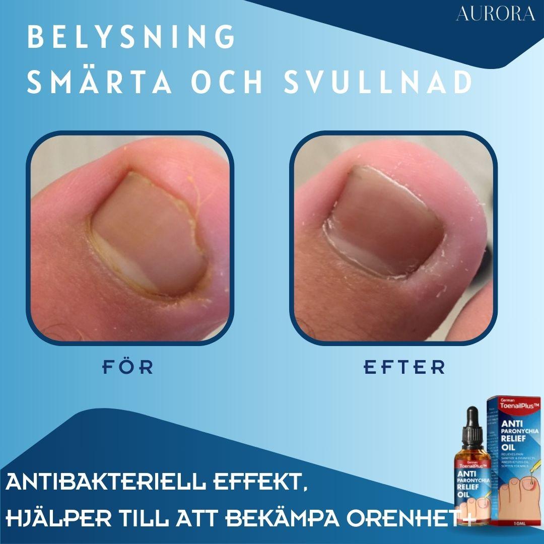 ToePerfect⹠- LÀker tÄnaglar och handnaglar | 1+1 FREE TEMPORARY - Aurora Stockholm
