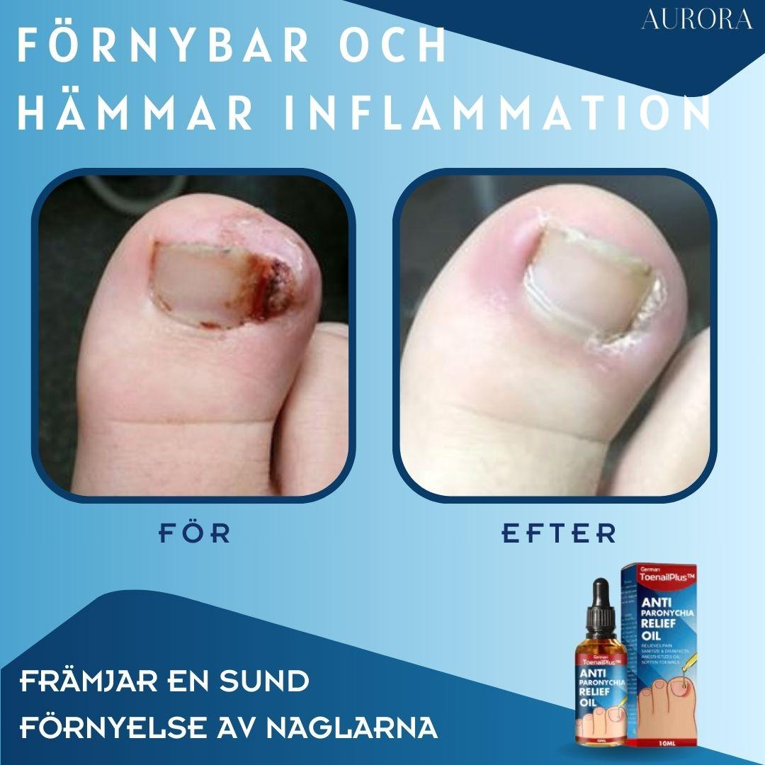 ToePerfect⹠- LÀker tÄnaglar och handnaglar | 1+1 FREE TEMPORARY - Aurora Stockholm