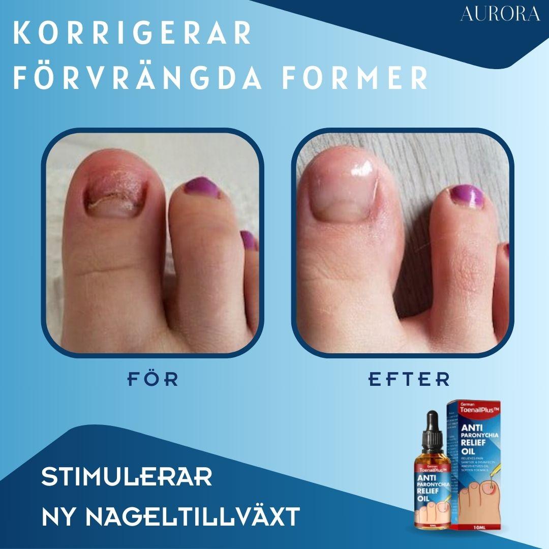 ToePerfect⹠- LÀker tÄnaglar och handnaglar | 1+1 FREE TEMPORARY - Aurora Stockholm