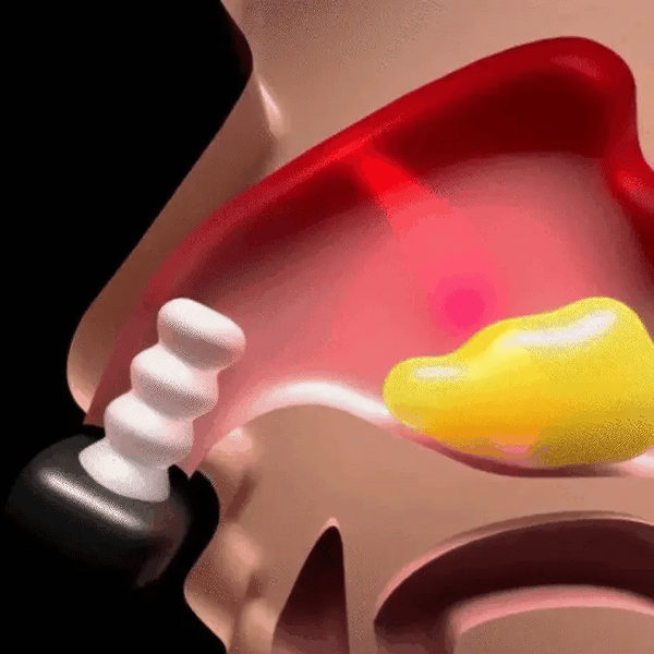 TILLFÄLLIGT 50% OFF  LumaBreathe™