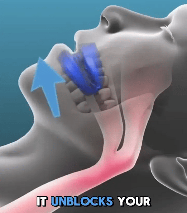 TILLFÄLLIGT 50% OFF  SnoreAway™