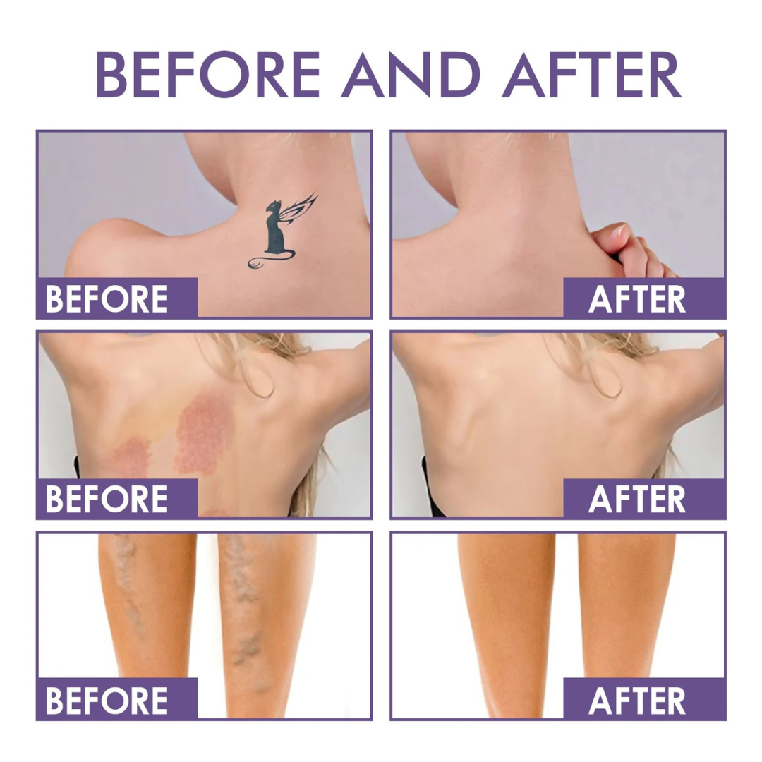 TILLFÄLLIGT 50% RABATT | DermaVelle™ | Felfri hud på några sekunder - utan filter!