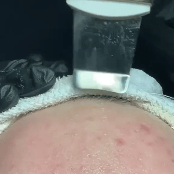 TILLFÄLLIGT 50% OFF  SkinSonic™